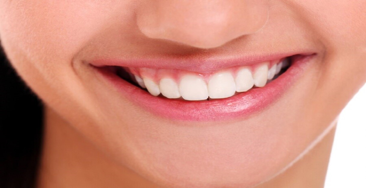 Teeth Whitening in Indore,best teeth whitening in indore,dentist in indore, dental clinic indore,